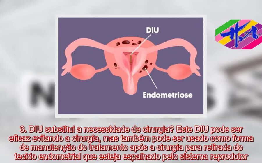 Mulher segurando dispositivo intrauterino hormonal com símbolo de plano de saúde ao fundo