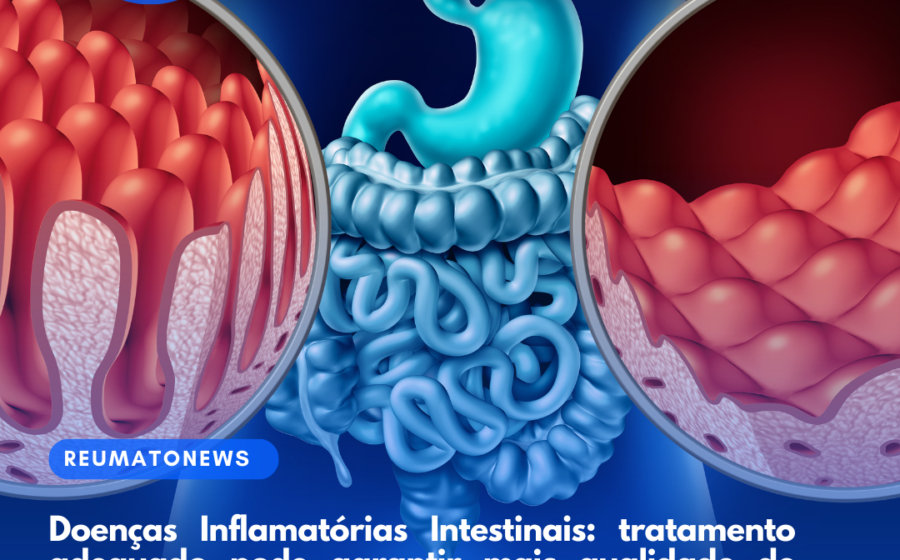 Gráfico mostra aumento de 426% em doenças inflamatórias intestinais no Brasil entre 2012 e 2025