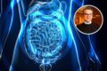 Gráfico mostra aumento de 5x nos casos de doenças inflamatórias intestinais no Brasil entre 2012 e 2025