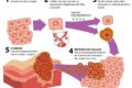 Ilustração científica de via metabólica alternativa de cisteína em células cancerígenas resistentes