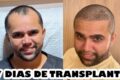 Marcos Taylor, 11 anos, sorrindo saudável dois anos após transplante de rim doado por enfermeira no Hospital das Clínicas de Ribeirão Preto