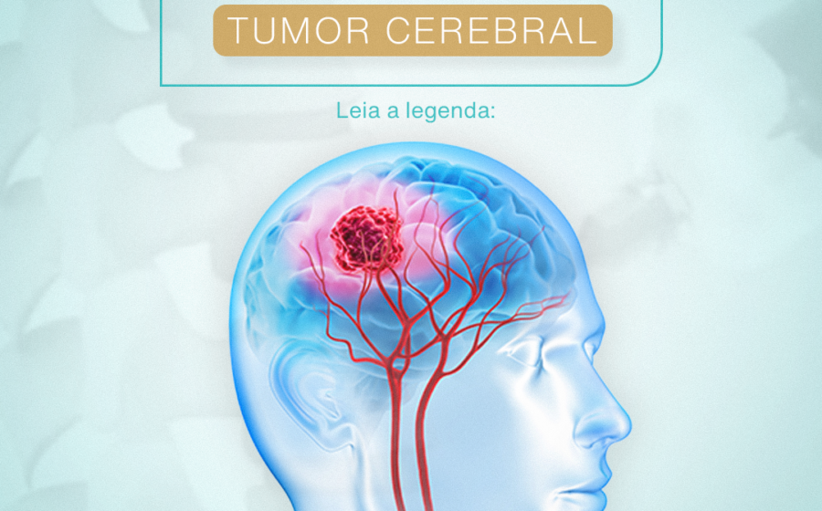 Exame genético ultrarrápido identifica tipo de tumor cerebral em menos de 2 horas no NHS