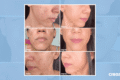 Kit Creamy com 4 produtos essenciais de skincare dermocosmético brasileiro