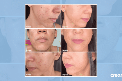 Kit Creamy com 4 produtos essenciais de skincare dermocosmético brasileiro