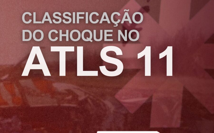 Gráfico mostra alíquota CBS 11,3% acima da projeção 9,5% para 2027