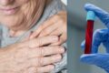 Exame de sangue para detectar biomarcadores de Alzheimer em laboratório brasileiro