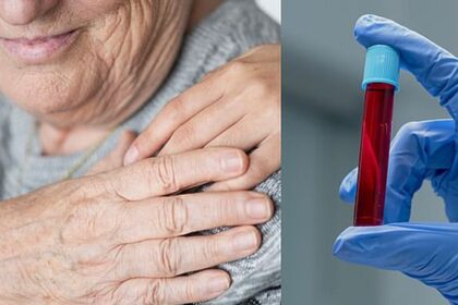 Exame de sangue para detectar biomarcadores de Alzheimer em laboratório brasileiro