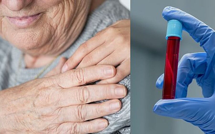 Exame de sangue para detectar biomarcadores de Alzheimer em laboratório brasileiro