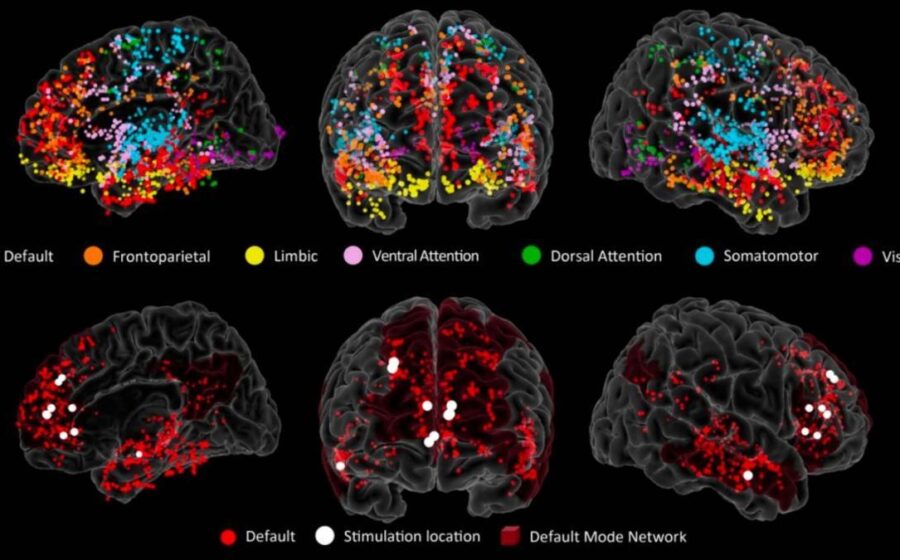 Ilustração científica do cérebro humano destacando córtex pré-frontal com células da glia inflamadas após os 60 anos