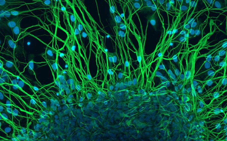 Pesquisador da USP usa optogenética para ativar neurônios com luz azul em cérebro de roedor