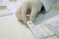 Mulher realizando exame molecular de DNA-HPV para detecção precoce de câncer de colo do útero no SUS