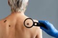Cientista em laboratório preparando vacina de mRNA personalizada da Moderna contra melanoma