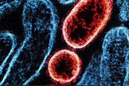 Microscópio eletrônico mostra partículas do vírus Shamonda, arbovírus transmitido por mosquitos, primeiro caso humano na Europa