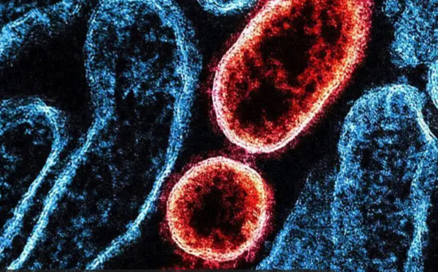 Microscópio eletrônico mostra partículas do vírus Shamonda, arbovírus transmitido por mosquitos, primeiro caso humano na Europa